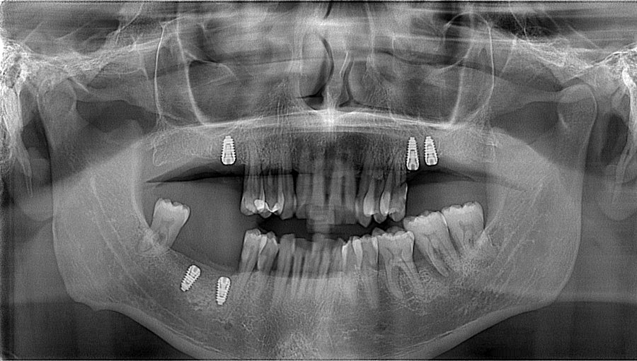 Radiografia panoramica dello studio